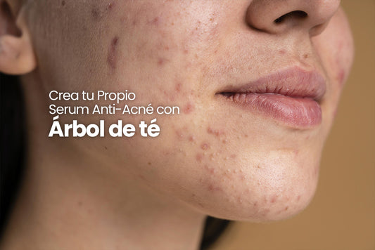 Crea tu Propio Serum Anti-Acné con Aceite Esencial de Árbol de té